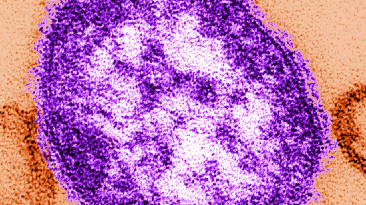 US measles cases are up in 2024. What's driving the increase?